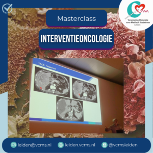 Read more about the article Terugblik Masterclass interventieoncologie